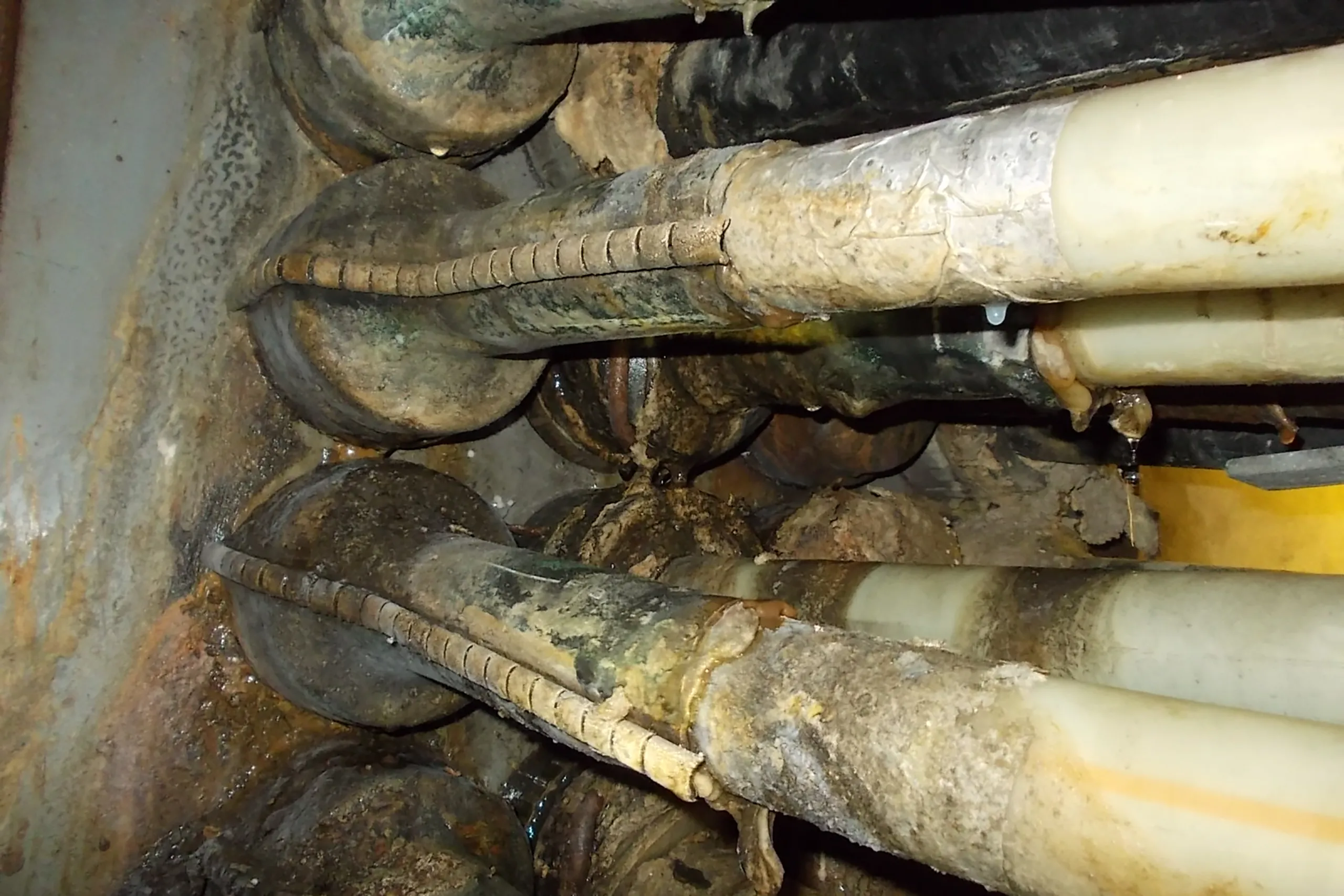 filoseal common duct sealing pitfalls